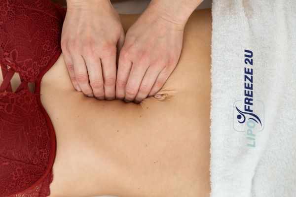 diastasis recti treatment Rushden