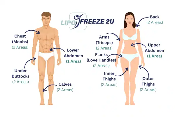 Areas you can have fat freezing treatment Rushden