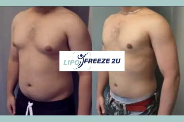How Long Does It Take to See Results Rushden?