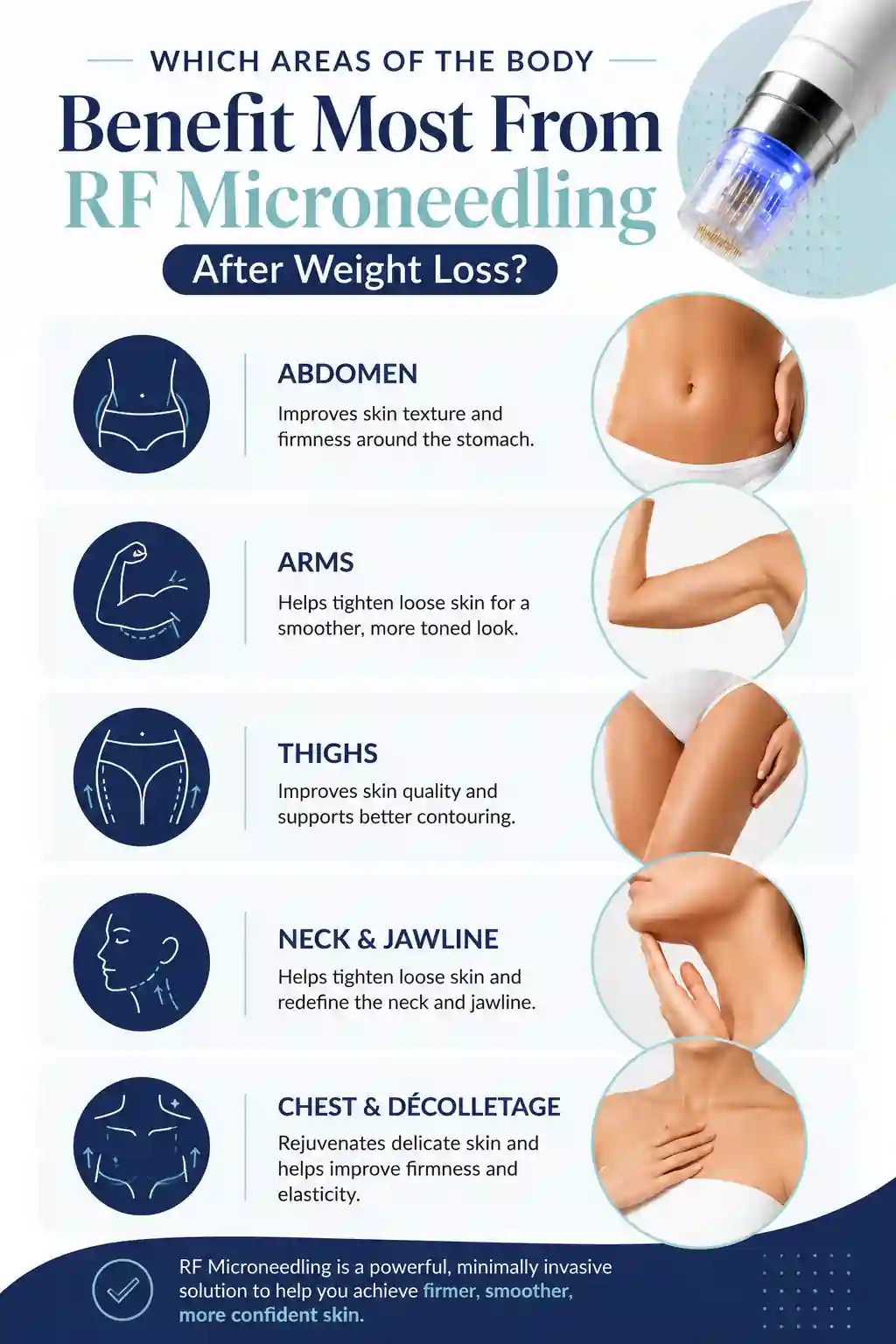 Which Areas of the Body Benefit Most From RF Microneedling After Weight Loss Rushden
